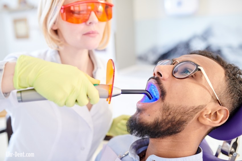 Що потрібно знати перед відбілюванням зубів